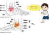 足首が痛ぁい